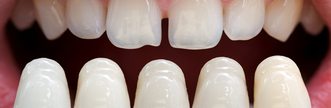 Revealed: Your Beautiful Smile With Hyde Park Dental Care