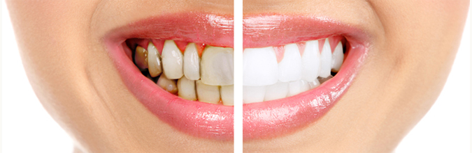 Surprise: A Dental Filling of the Wrong Sort