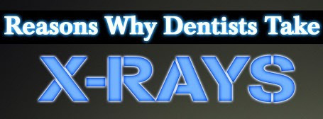 5 reasons your dentist might request a dental x-ray