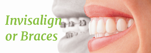 Is Invisalign Better For You Than Braces?