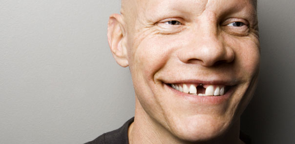 What will happen if you don’t replace that missing tooth