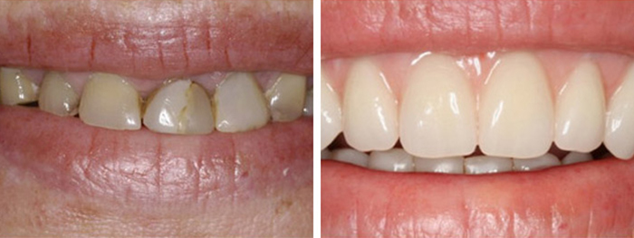 Dental Smile Gallery