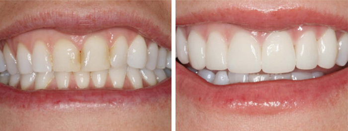 Dental Smile Gallery