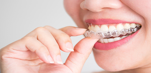 4 Tips for New Invisalign Users