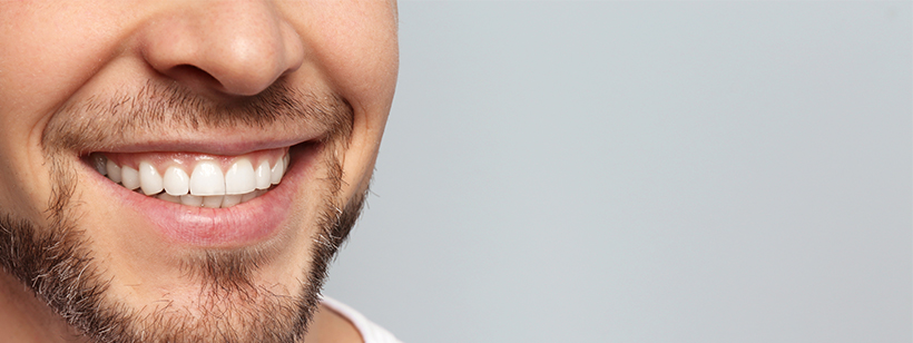 How to straighten your teeth quickly